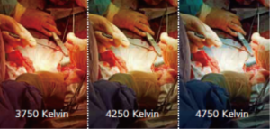 Medical Cold Light Lamp